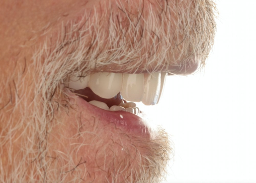 Slider image (6) Art Dental Care